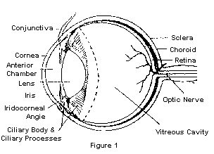 cataracts diagram